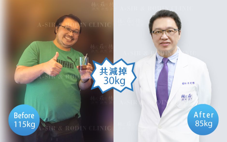 瘦身 減肥 減重 善纖達 Saxenda